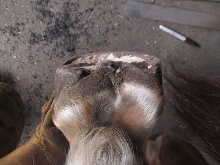 Sheared heels, deficient lateral wall
